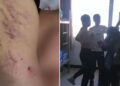 4 học sinh đánh hội đồng bạn cùng lớp, cách xử lý của nhà trường khiến phụ huynh bất bình vì “không thể hiểu nổi”