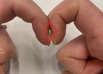 Bài kiểm tra 5 giây đánh giá nguy cơ ung thư phổi: Ai thấy hình thoi thì có thể yên tâm