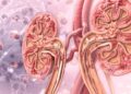Người có axit uric máu cao thường có 4 đặc điểm này: Có 1 cũng khiến thận suy hỏng lúc nào không hay