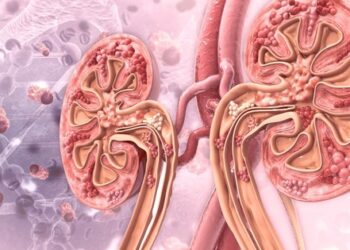 Người có axit uric máu cao thường có 4 đặc điểm này: Có 1 cũng khiến thận suy hỏng lúc nào không hay