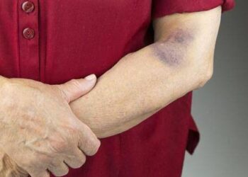 Bất kể nam hay nữ, nếu có 2 triệu chứng sau ở cánh tay thì có thể là ung thư, nên đi khám và điều trị càng sớm càng tốt