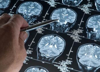 Người phụ nữ 52 tuổi tử vong vì vỡ mạch máu não: Có 2 dấu hiệu cảnh báo sớm nhưng đã bỏ qua