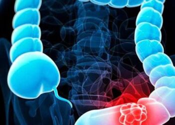 Mắc ung thư giai đoạn 4 ở tuổi 37, nữ bác sĩ cảnh báo 2 dấu hiệu dù nhẹ cũng không được bỏ qua