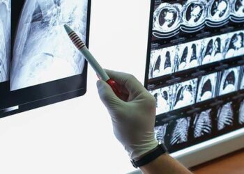 Đau chân kéo dài, người phụ nữ đi khám, phát hiện ung thư ở vị trí không ngờ tới