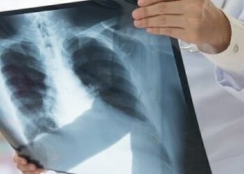 Dấu hiệu cảnh báo phổi đang kêu cứu