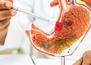 Nghiên cứu mới: Dùng quá nhiều 1 loại gia vị có thể làm tăng 41% nguy cơ mắc ung thư dạ dày