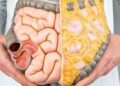 1 chỗ “dày” báo hiệu người tuổi thọ ngắn: ăn gì để giảm nguy cơ?