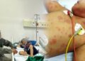 Một gia đình 2 người tử vong, 2 người nguy kịch, nguyên nhân liên quan căn bệnh ít người để ý tiêm phòng